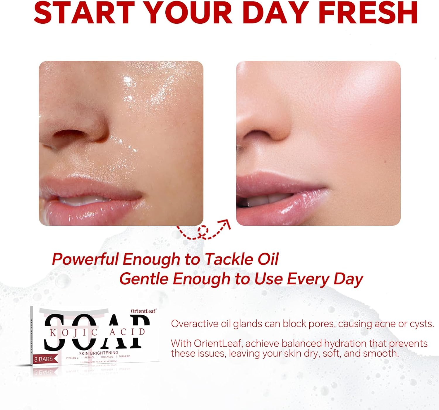 Kojic Acid Soap, Turmeric Soap Bar for Dark Spots, Fresh Citrus Scent, Gentle for Face and Body with Vitamin C, Shea Butter, Retinol, Olive Oil, Collagen (3 PACK) - Image 2