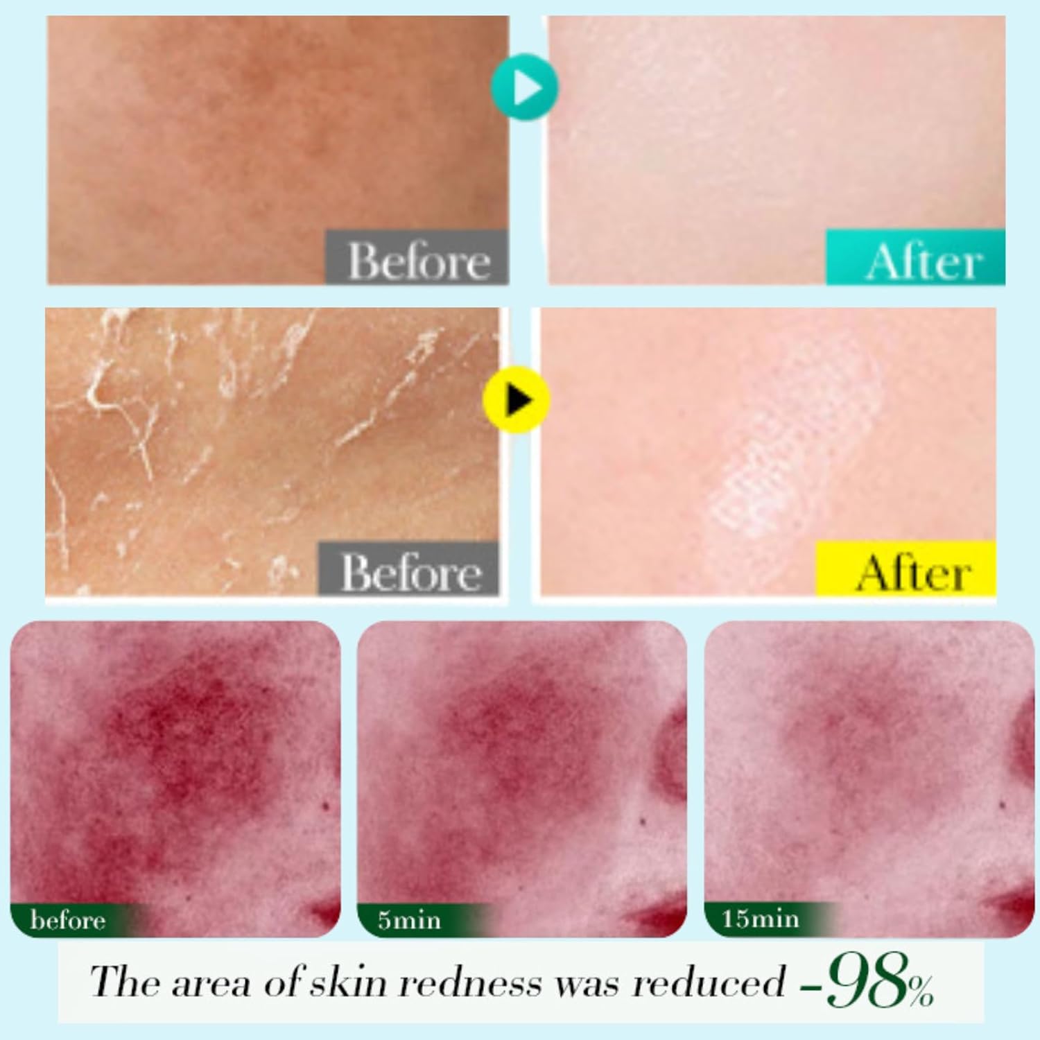 6-Piece Korean Face Mask-Sheet Masks –Brightening Vitamin C,Niacinamide, Hydrating Hyaluronic Acid for All Skin Types -Self Care Gift Set for Women & Teens-Skincare Sets & Self Care Essentials - Image 6