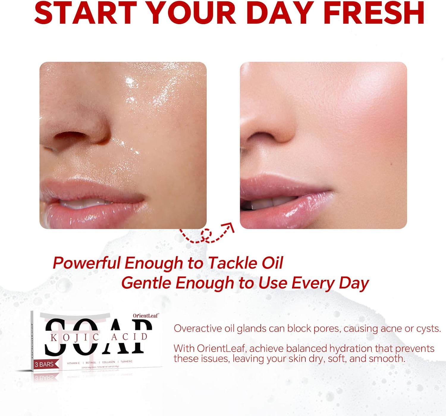 Kojic Acid Soap, Turmeric Soap Bar for Dark Spots, Fresh Citrus Scent, Gentle for Face and Body with Vitamin C, Shea Butter, Retinol, Olive Oil, Collagen (3 PACK) - Image 4